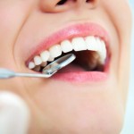 Dental Veneers: Checkups