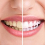 Prosthodontist Cosmetic Enhancement