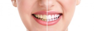 Prosthodontist Cosmetic Enhancement