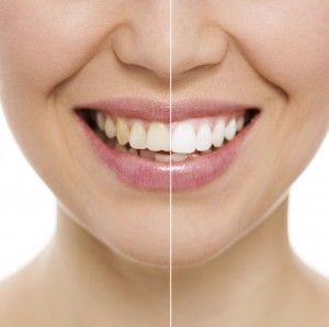 cheap-dental-implants-Health