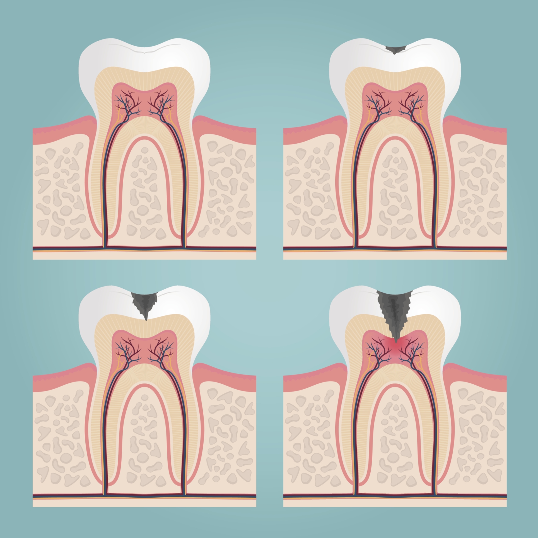 Crown Tooth Pain? We Can Help Dr. Stone, DDS