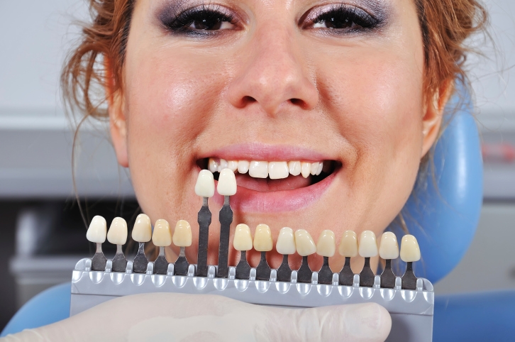 What Causes Yellow Teeth: 50 Shades of White