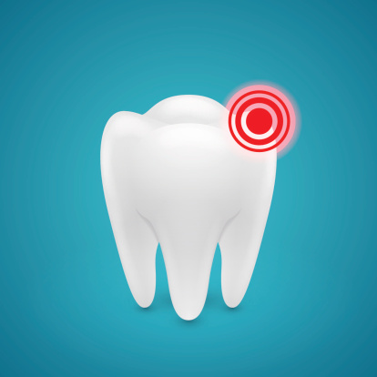 Cracked Tooth Repair - Dr. Stone, DDS