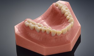This dental replica was made using a 3D printer. Researchers are now working on ways to make 3D-printed teeth resistant to bacteria. Photograph: Stratasys