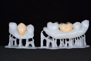 Printing-3D-teeth