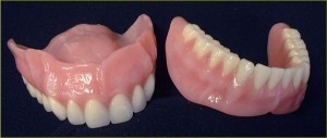 All on 4 Dental Implants - dentures