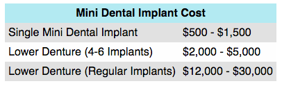 The Cost of Mini Dental Implants