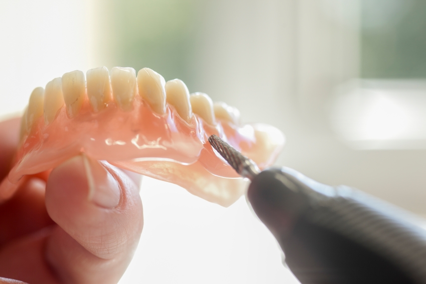 Cost of dental implants - Dentures