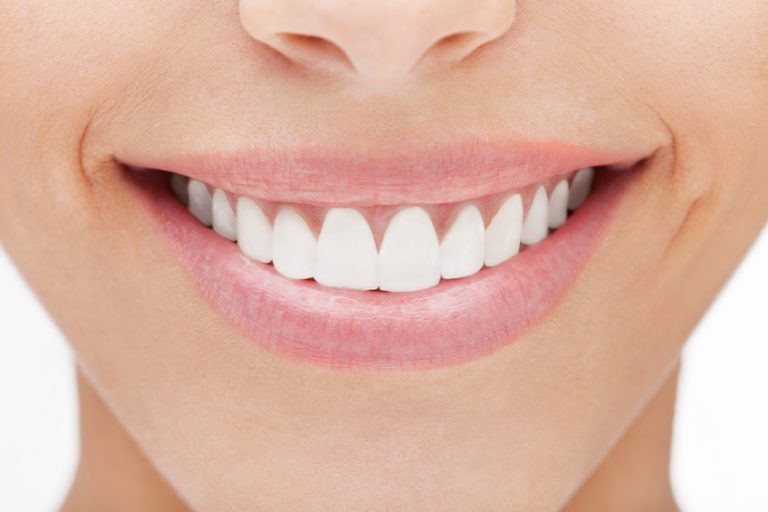 A Guide To Fixing Chipped Teeth