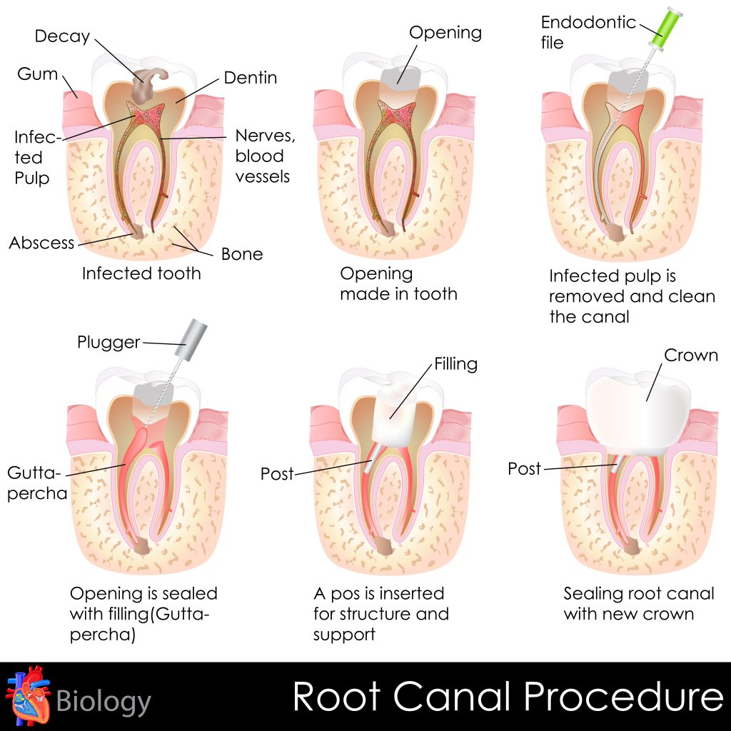 how-can-i-tell-if-my-tooth-is-dead-dental-care-report