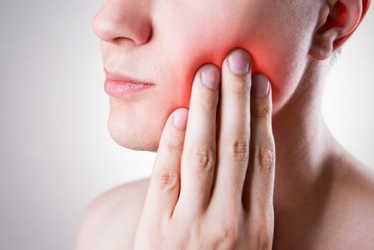 Nerve Tooth Pain