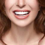What are Teeth Implants in One Day?