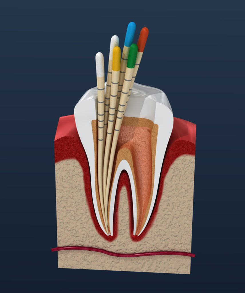 hiri etessami dds endodontist